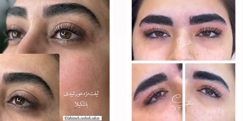 لیفت مژه خورشیدی