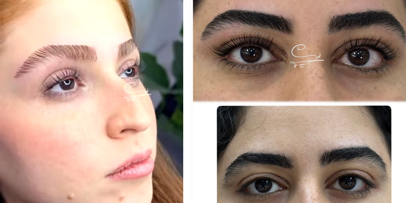 لیفت مژه خورشیدی
