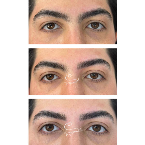 نمونه کار اصلاح ابرو