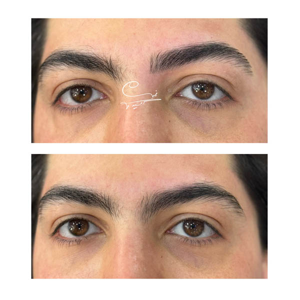 نمونه کار اصلاح ابرو