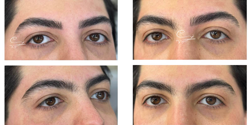 اصلاح ابروی طبیعی