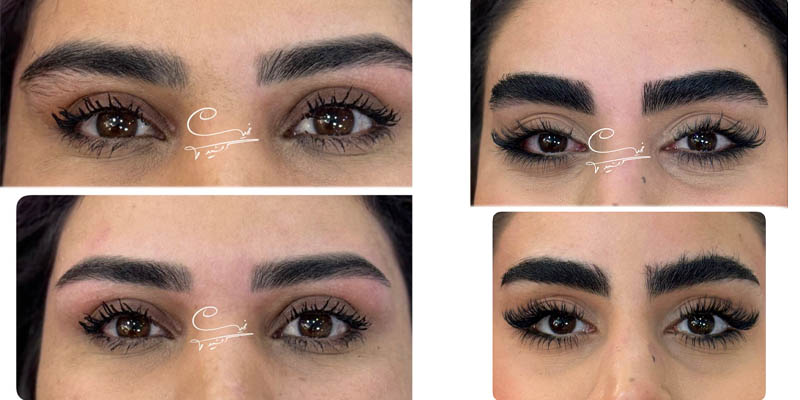 اصلاح ابروی طبیعی