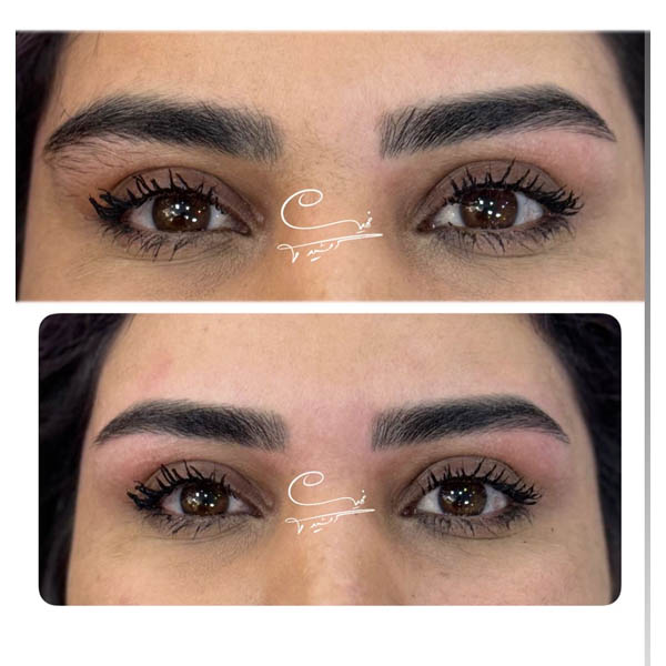 نمونه کار اصلاح ابرو