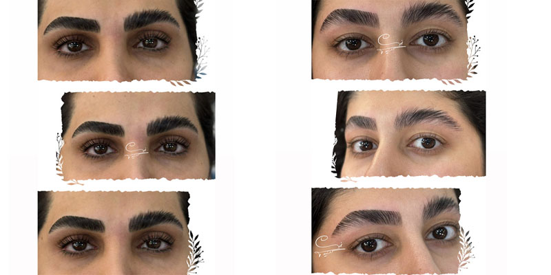 علت فر شدن ابرو بعد از لیفت 