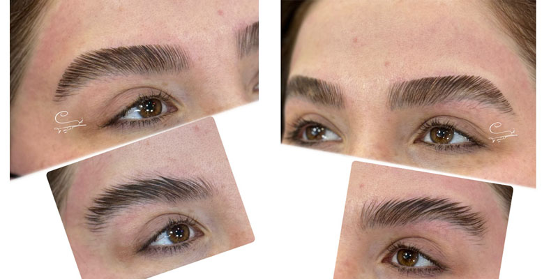 علت فر شدن ابرو بعد از لیفت 